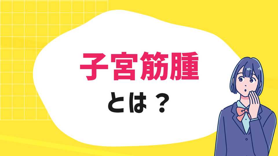 子宮筋腫とは？知っておきたい女性の病気
