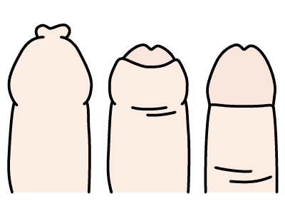 陰茎のイメージ画像です。