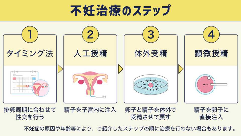 不妊治療のステップ