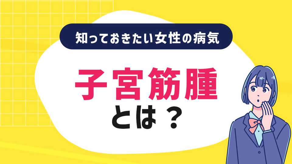 子宮筋腫とは？知っておきたい女性の病気